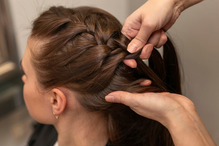 Implante Capilar: O Protocolo Pós-Operatório e a Viabilidade Estética de Fazer Penteados