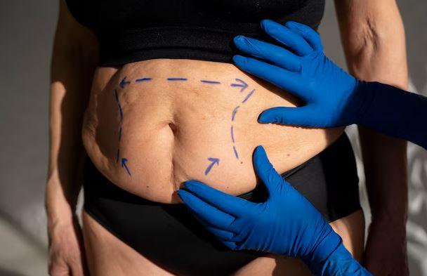 Cirurgia bariátrica e autoestima: mudanças que vão além do peso